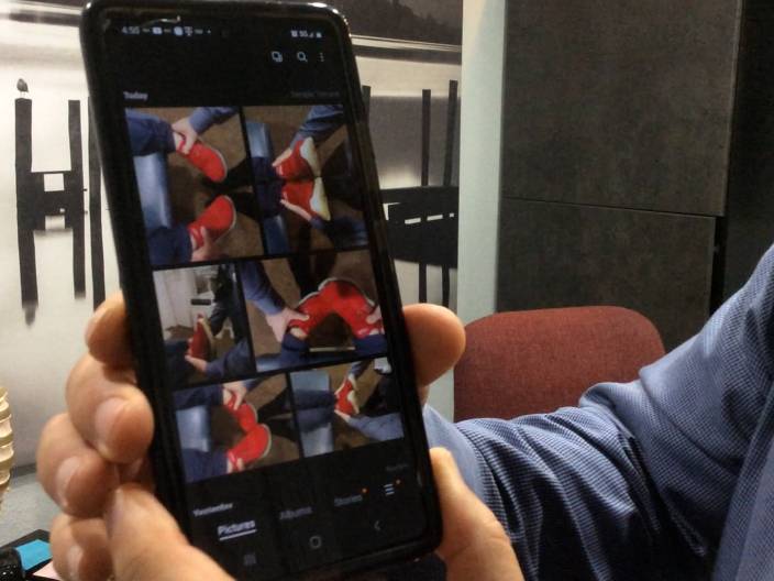 Leg Length Evaluation